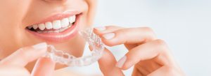 Invisalign Kimlere Yapılır