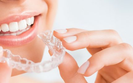 Invisalign Kimlere Yapılır