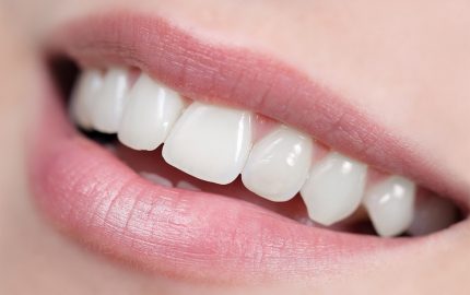 zirkonyum diş kaplaması neden tercih edilir