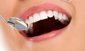 Zirkonyum Diş Kaplama Avantajları Nelerdir?