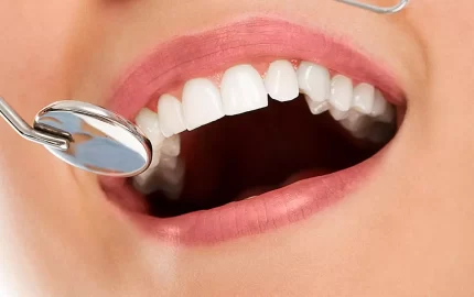 Zirkonyum Diş Kaplama Avantajları Nelerdir?